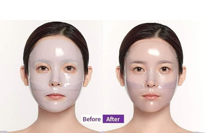 MEDIANSWER CALMING COLLAGEN MASK 5PK