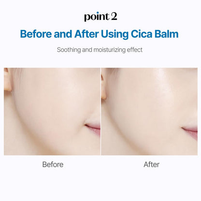 (23AD) SOONJUNG 10 Panthensoside Cica Balm 50ml