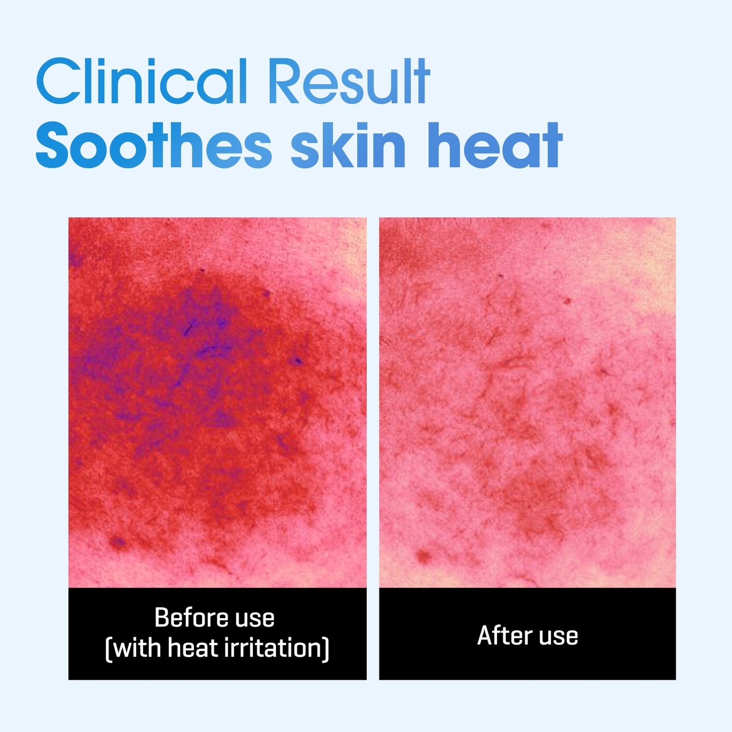BETA PANTHENOL REPAIR DAILY MASK [30ea]